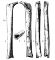 Femur IV