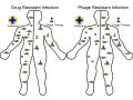 Phage therapy is the use of bacteriophages to treat bacterial infections. This could be used as an alternative to antibiotics when bacteria develops resistance. Superbugs that are immune to multiple types of drugs are becoming a concern with the more frequent use of antibiotics. Phages can target these dangerous microbes without harming human cells due to how specific they are. When bacteria develop immunity to phages they generally have to give up their antibiotic resistance, always leaving a weakness that allows us to treat against them.