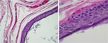 Histopathology