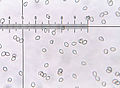 Sporen von Chlorophyllum molybdites im Lichtmikroskop