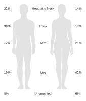 Diagram showing where melanoma is most likely to develop