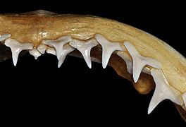 Upper teeth