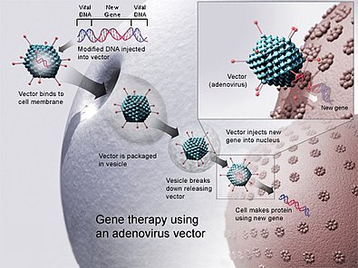 Gene therapy using adenovirus vector