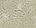 Streptococcus iniae, a Gram-positive, sphere-shaped bacteria caused losses in farmed marine and freshwater finfish of US$100 million in 1997.[30]