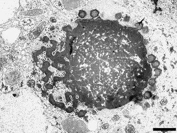 Nachkommenschaft des „Sputnik 3“ Virophagen, produziert in einer Virusfabrik (VF) von Gruppe-A-Mimiviren. Balken 1 µm.[5]