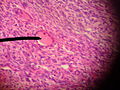 transitional primary follicle.