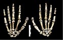 Handknochen des Homo naledi