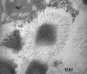 TEM-Aufnahme eines Mimivirus-Virions (ApMV) mit Stargate und Filamenten.[22]
