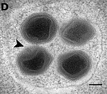 Neu gebildete BsV-Virionen im Inneren eines Vesikels. Am Apex des linken un­teren Virions befindet sich ein geschlossenes Stargate (schwarze Pfeilspitze).[23]