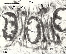 Chiton epidermis TEM