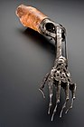 Arm- und Handprothese aus dem 19. Jahrhundert