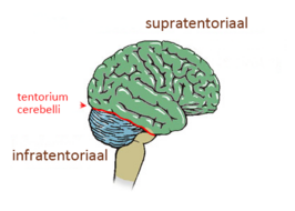 Tentorium cerebelli