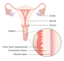 Diagram of the female reproductive anatomy with layers of the vaginal wall enhanced and labeled