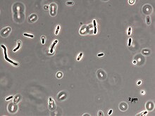 Image of Aquabacterium limnoticum