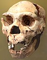 A skull with jaw missing its lower incisors and canines, and all of its upper teeth except for one incisor and its molars, and a broken right brow ridge
