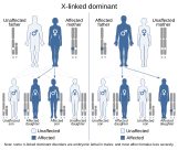 X-linked dominant inheritance