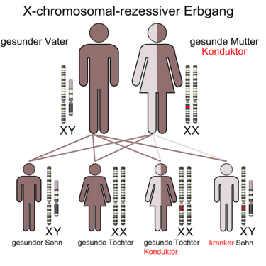 X-chromosomal durch die Mutter vererbtes, rezessives Merkmal. 50 % der Söhne tragen das Merkmal, 50 % der Töchter geben es weiter, ohne selbst betroffen zu sein.