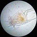   And yet another rotifer.