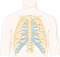 Rib fractures