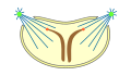 semiopen pleuromitosis