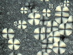 Sphärolithstrukturen von Polyamid 6.6 im Polarisationskontrast