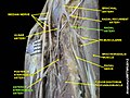 Anterior interosseous artery