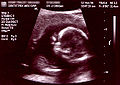 Thumbnail for version as of 23:17, 14 June 2007