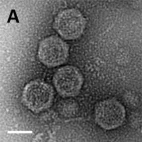 Negativ einer EM-Aufnahme gereinigter Sputnik-Virophagenpartikel. (Balken 500 nm).[8]