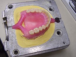 Eingebettete Prothese aus Wachs in einer Küvette zur Kaltpolymerisation