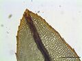 tip of the leaf, magnified 125x, Photo by Kristian Peters