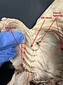 Image 19A ventral dissection of a pregnant female dogshark exposing its internal gill slits and internal spiracles. (from Shark anatomy)