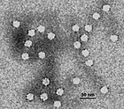 Electron micrograph of canine parvovirus