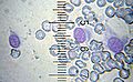   Three basophil granulocytes, which are another type of white blood cell.