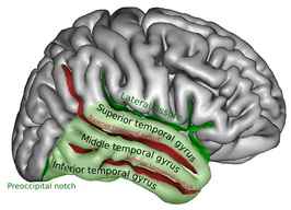 Gyrus temporalis superior aangegeven als 'superior temporal gyrus'.