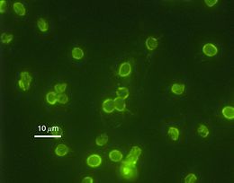 Immunfluoreszcenciás kép a C. parvum oocitáiról