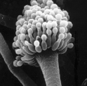 Elektronenmikroskopaufnahme des Sporenträgers von Aspergillus fumigatus