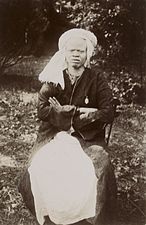 1894. Photo of a black albino woman from Senegal by Joannès Barbier on the occasion of the colonial exhibition in Lyon.