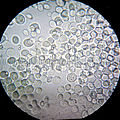   Saccharomyces cerevisiae, the common baker's yeast.