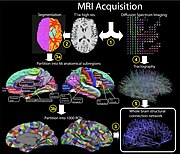 Process from MRI acquisition to whole brain structural network[21]