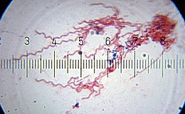 Gram-festett spirochaeták.  A skála számozott beosztásai közötti távolság 11 µm.