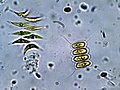 Scenedesmus quadricauda under a light microscope