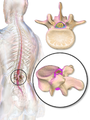 Dura mater (spinal section)