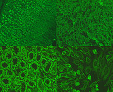 Picture of immunofluorescence staining pattern of AMA antibodies.