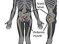 Hình xem trước của phiên bản lúc 05:07, ngày 15 tháng 11 năm 2016