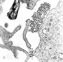 Dang virüsünü gösteren geçirimli elektron mikroskopisi