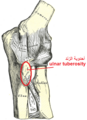 Tuberosity of the ulna.