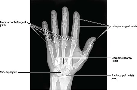 Hand Joints, X-ray