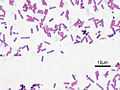 Basil (Bacillus subtilis)