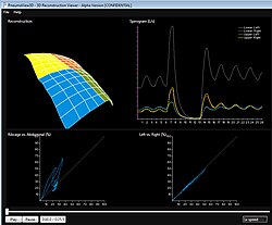 Healthy Patient SLP Scan