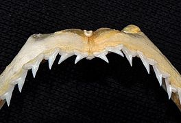 Upper teeth